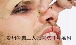 导致鼻出血的因素都有哪些