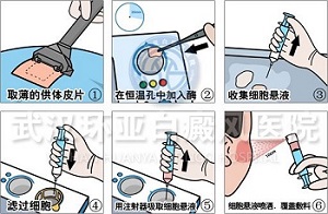 特色疗法 特色疗法