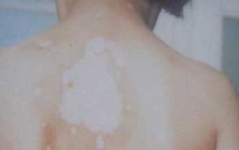 武汉白点丛环亚 武汉白点开环亚