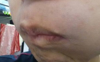 武汉白癜风治疗最好医院 武汉白癜风治疗医院