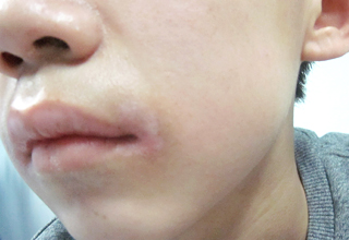 武汉治疗白癜风最好医院 武汉治疗白癜风比较好的医院