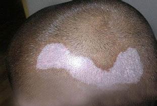 �人���ΰװߵ�ҽԺ��