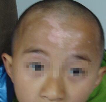 �人����������ưװ�