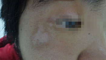 �人�������ưװߵ�ҽԺ