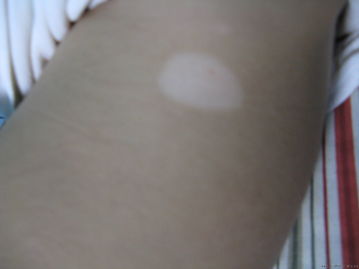 �人�������ļ�ҽԺ���