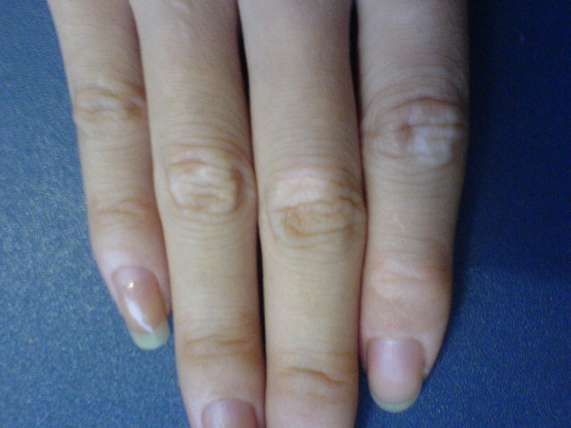 �人���￴����ȽϺ�