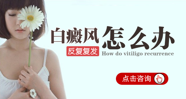 治疗白癜风的关键是什么 儿童患了白癜风能否被治好