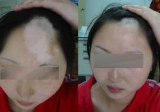 Ů˰ʲô֢״人Ķư磿