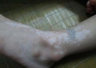 人жͯҽԺΰװߣͯЧԶװ߲ķ