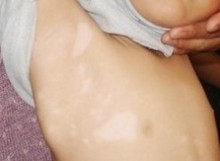 武汉专治白癜风医院在哪?哪个才是白癜风的好治疗法 武汉治白癜风去哪里?要怎样治疗白癜风效果好