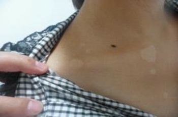 人ĸҽԺΰãƻϰװ߲Чķ