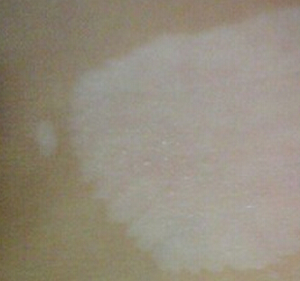 人ҽԺ̵ͯȷϷʽʲô